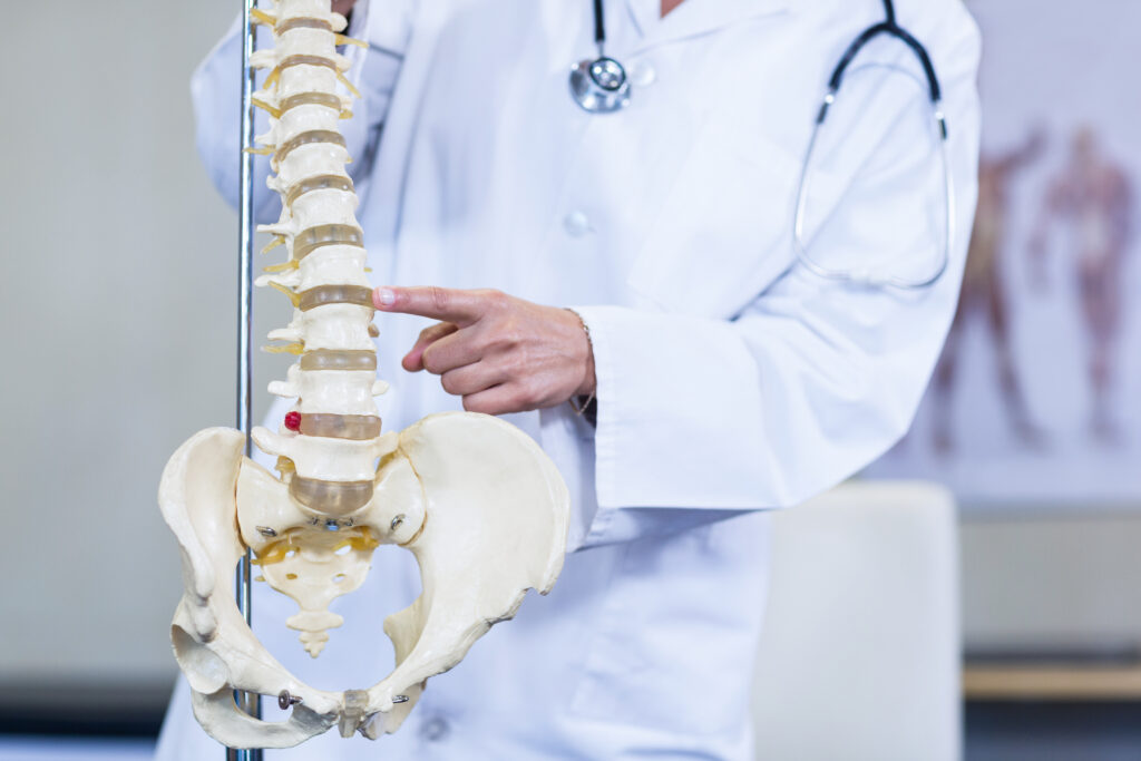 What Is A Disc Desiccation and How This Injury Effects Your Personal Injury Case? PereGonza